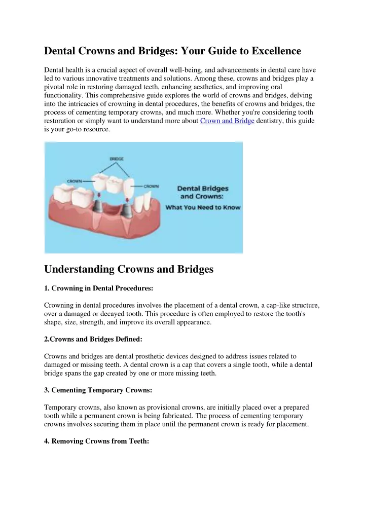 dental crowns and bridges your guide to excellence
