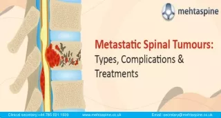 Metastatic Spinal Tumours:Types, Complications & Treatment