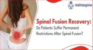 Spinal Fusion Recovery: Your Guide to a Healthy Back | Mehta Spine