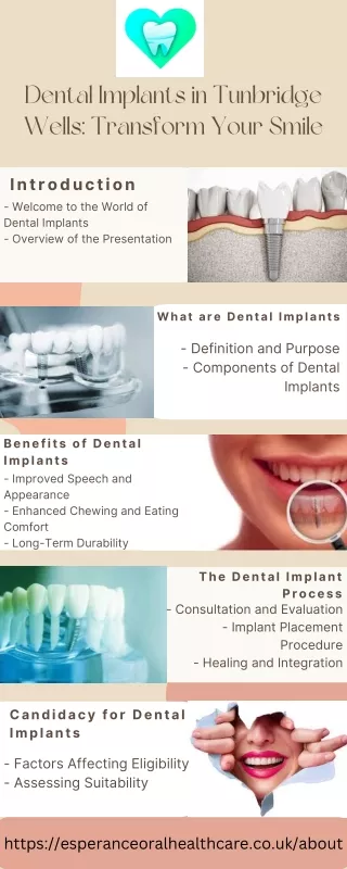 Dental Implants in Tunbridge Wells Transform Your Smile
