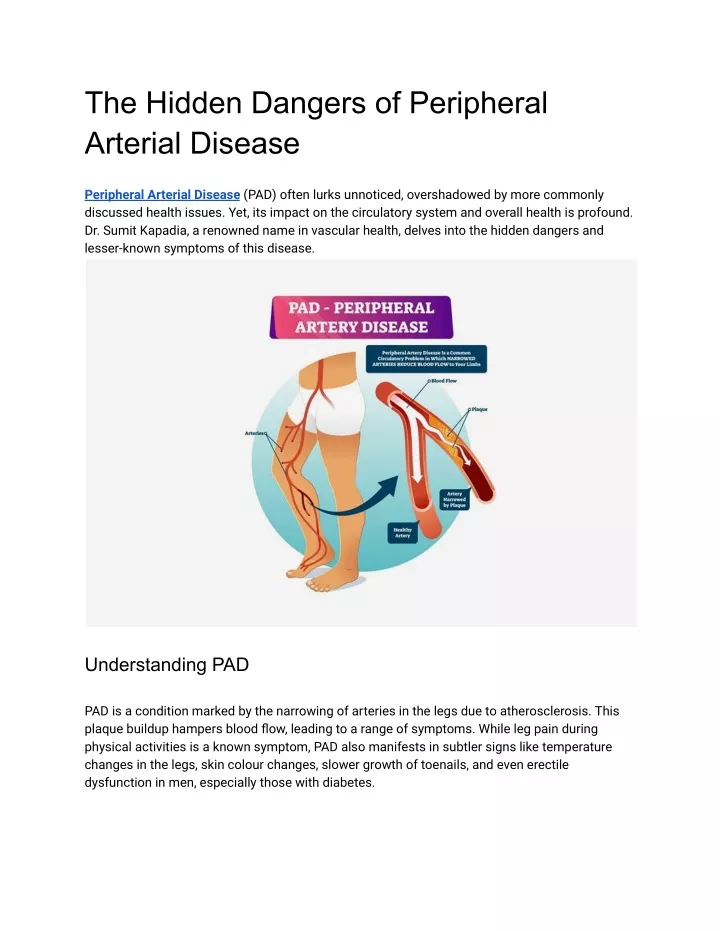 the hidden dangers of peripheral arterial disease