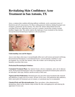 Revitalizing Skin Confidence Acne Treatment in San Antonio, TX