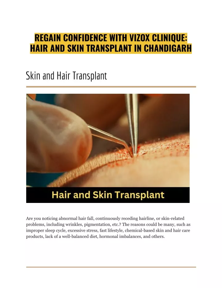 regain confidence with vizox clinique hair