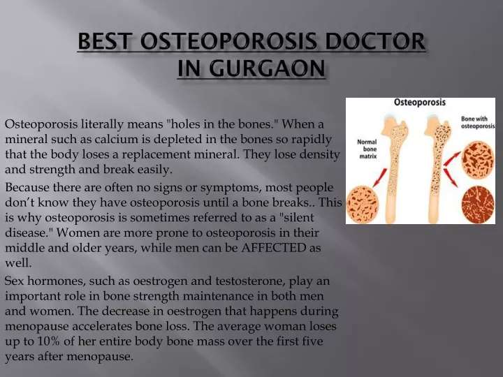 best osteoporosis doctor in gurgaon