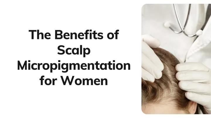 the benefits of scalp micropigmentation for women