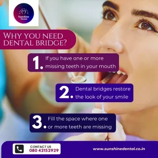 Why you need dental bridge | Best Dental Clinic in Whitefield | Sunshine Dental