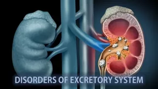 Disorders of excretory system