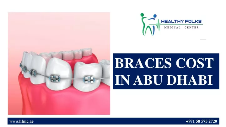 braces cost in abu dhabi