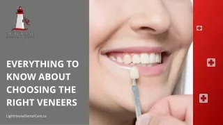 Everything To Know About Choosing The Right Veneers