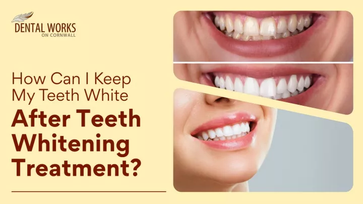 how can i keep my teeth white