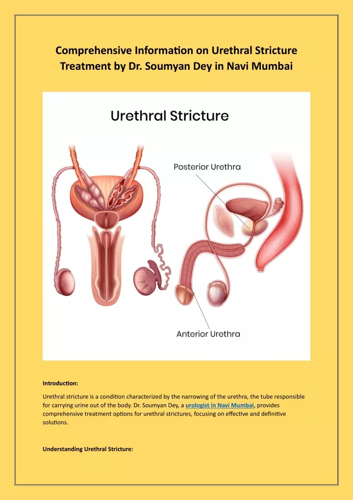 comprehensive information on urethral stricture