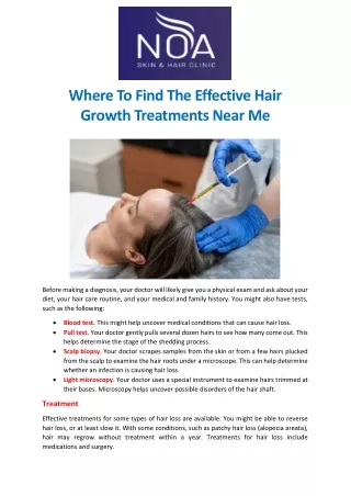 Where to find the effective hair growth treatments near me