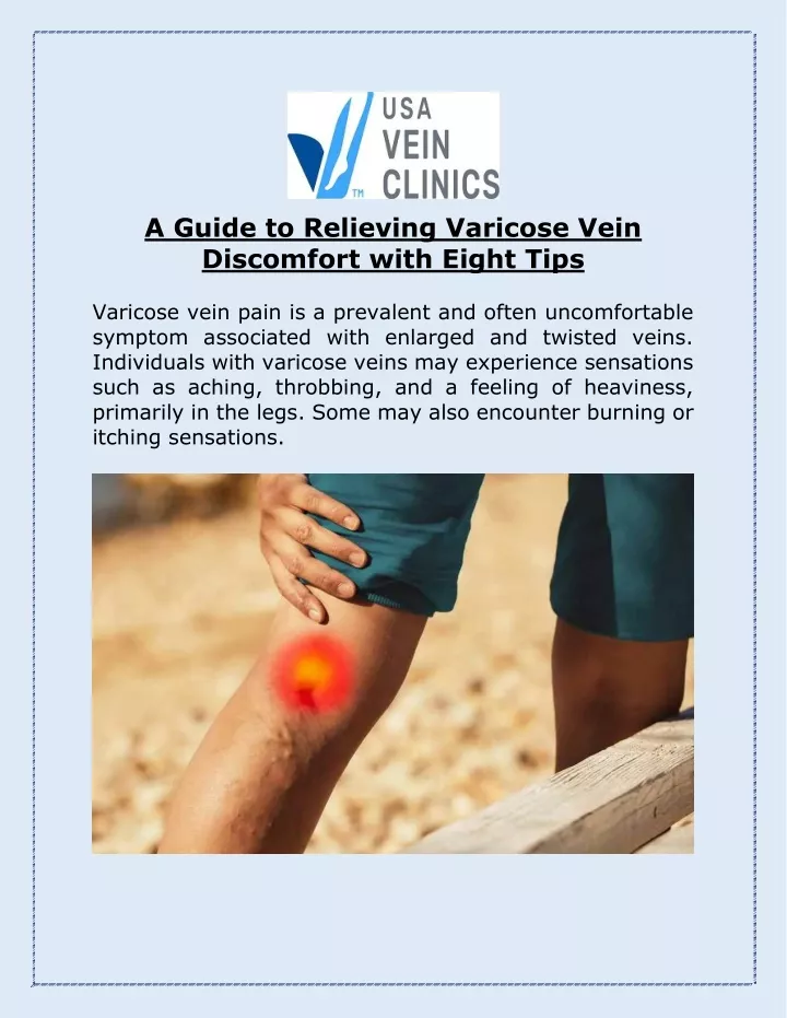 a guide to relieving varicose vein discomfort