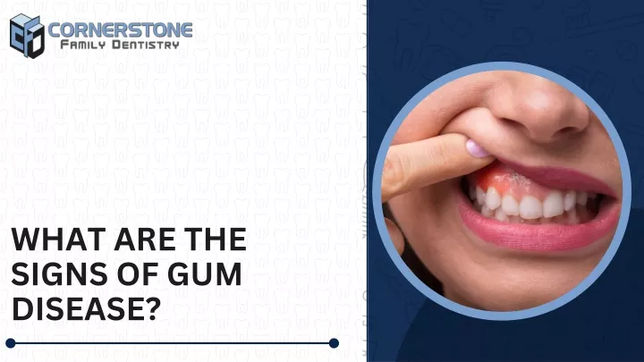 what are the signs of gum disease