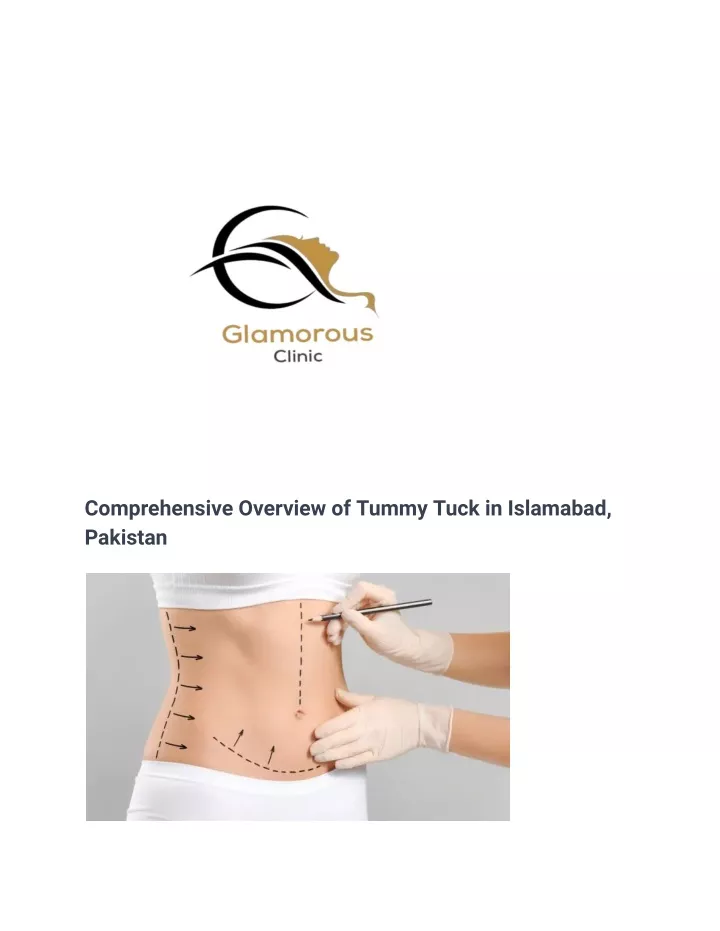 comprehensive overview of tummy tuck in islamabad