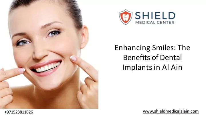 enhancing smiles the bene t s of dental implants in al ain