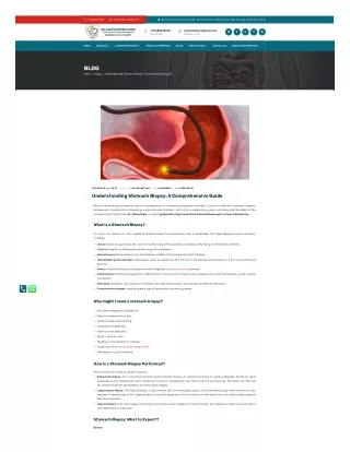 Understanding Stomach Biopsy: A Comprehensive Guide- Dr. Vikrant Kale