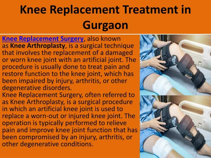 knee replacement treatment in gurgaon
