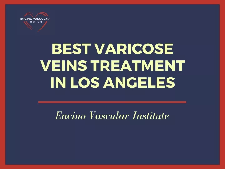 best varicose veins treatment in los angeles