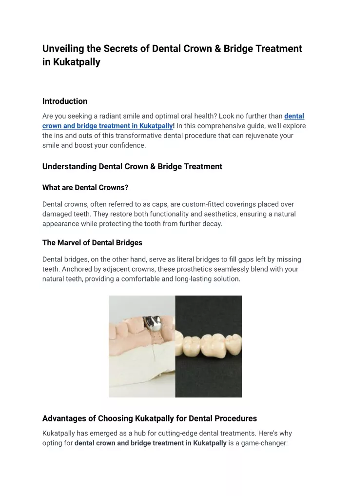 unveiling the secrets of dental crown bridge