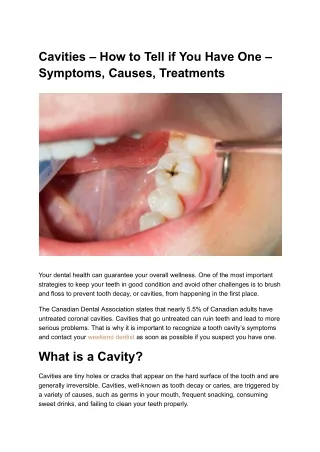 Cavities – How to Tell if You Have One – Symptoms, Causes, Treatments