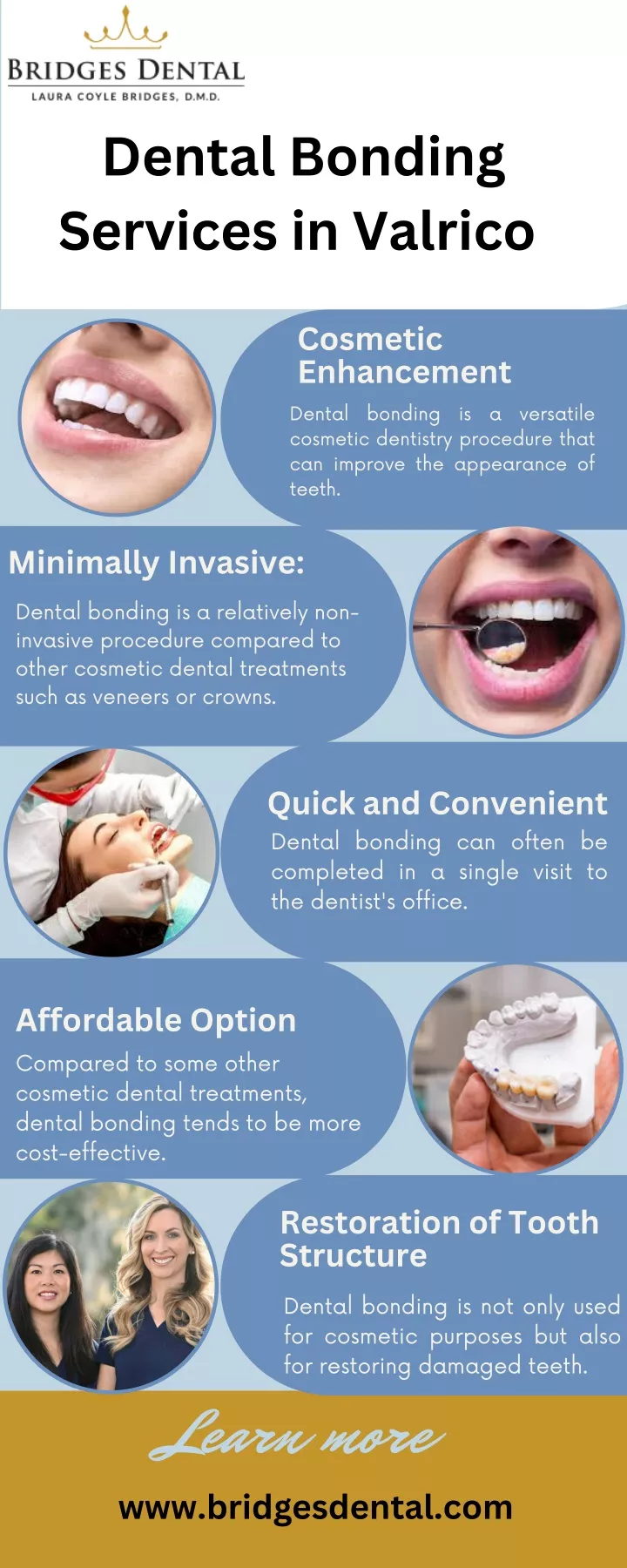 dental bonding services in valrico