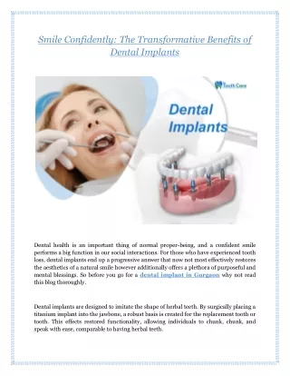 Smile Confidently: The Transformative Benefits of Dental Implants