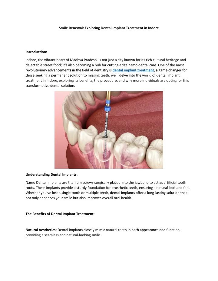 smile renewal exploring dental implant treatment