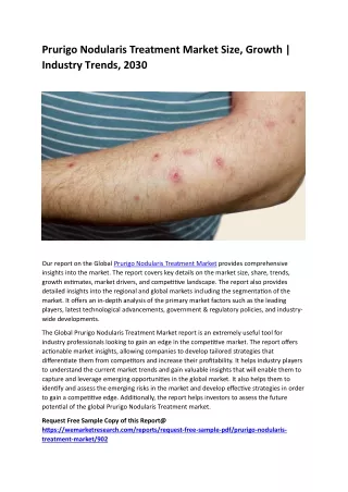 prurigo nodularis treatment market size growth