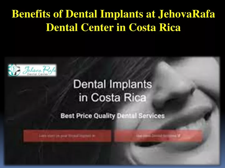 benefits of dental implants at jehovarafa dental