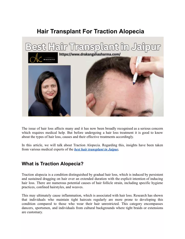 hair transplant for traction alopecia