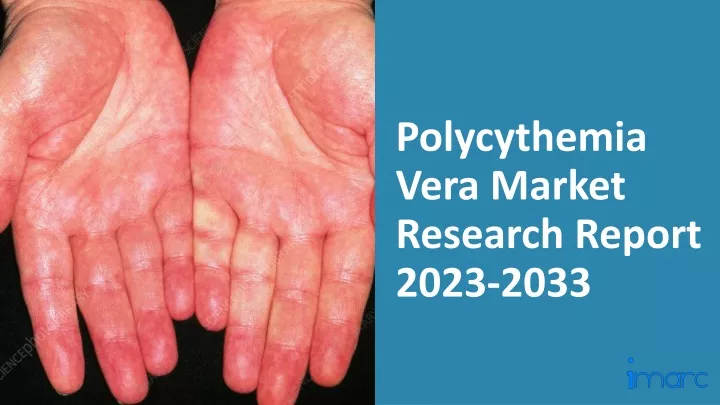 polycythemia vera market research report 2023 2033