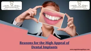 Reasons for the High Appeal of Dental Implants