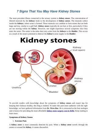 7 signs that you may have kidney stones