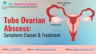 Tubo Ovarian Abscess: Symptoms Causes Treatment	| Dr Neelima Mantri