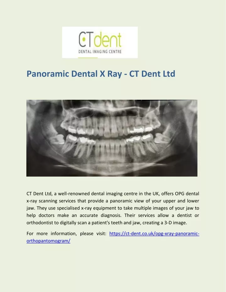 panoramic dental x ray ct dent ltd
