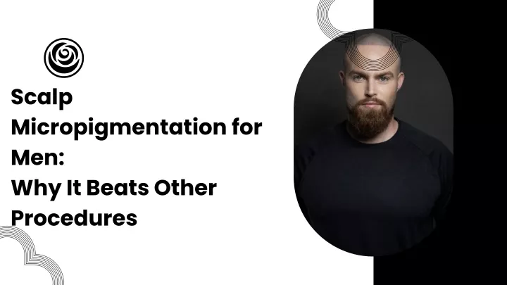 scalp micropigmentation for men why it beats