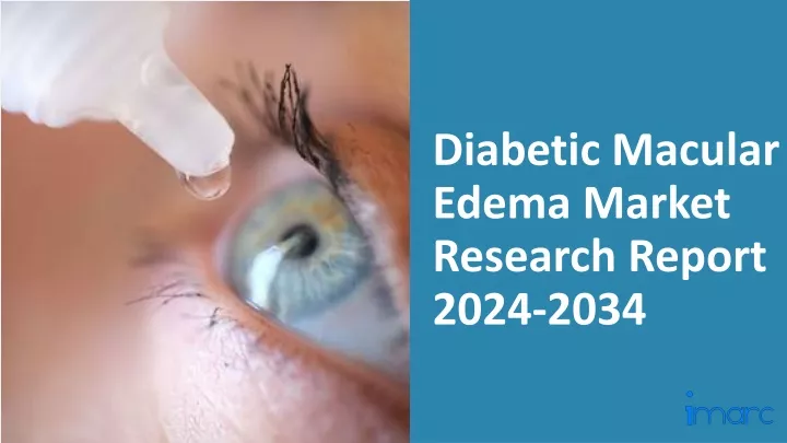diabetic macular edema market research report 2024 2034