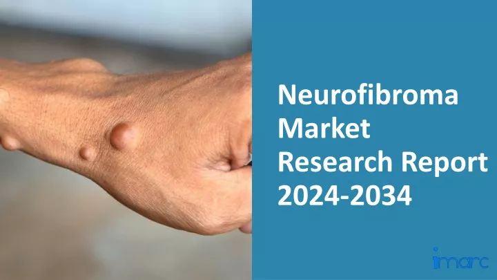 neurofibroma market research report 2024 2034