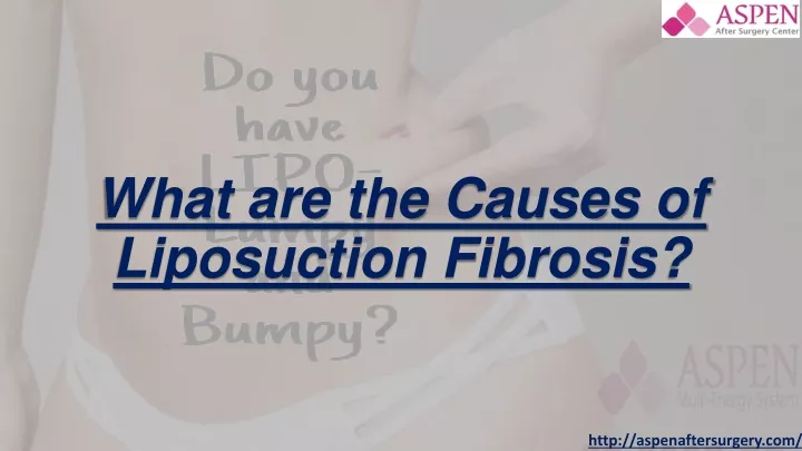 what are the causes of liposuction fibrosis