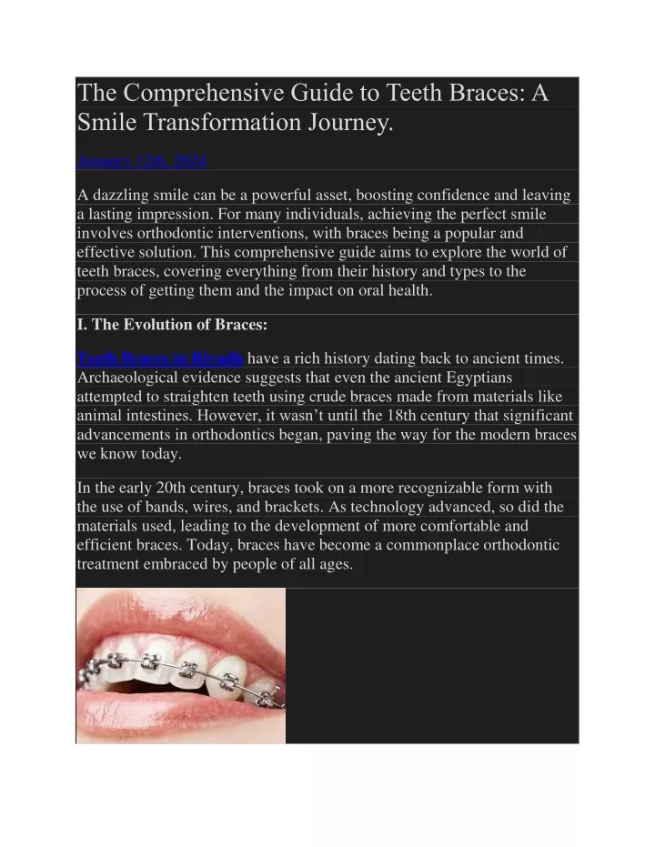 the comprehensive guide to teeth braces a smile