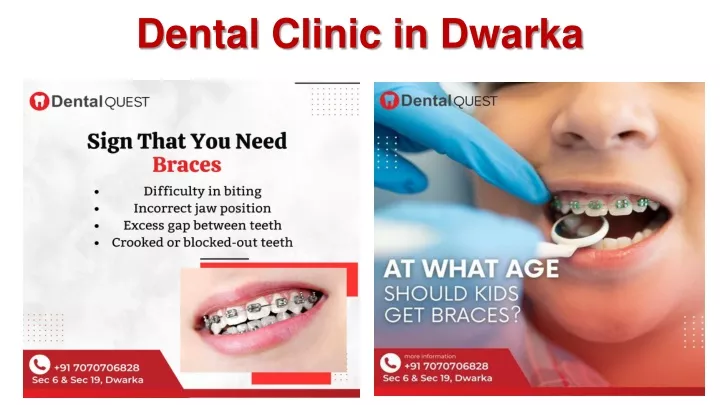 dental clinic in dwarka