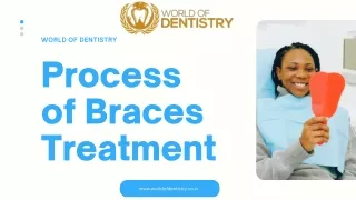 Process of Braces treatment