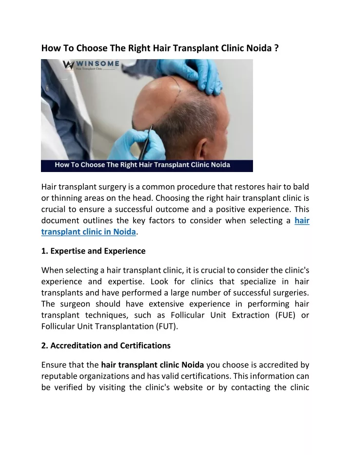 how to choose the right hair transplant clinic
