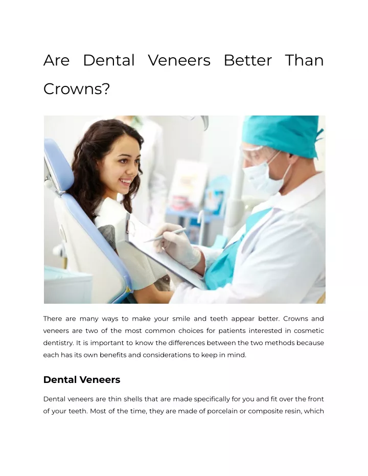 are dental veneers better than
