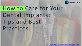 How to Care for Your Dental Implants Tips and Best Practices