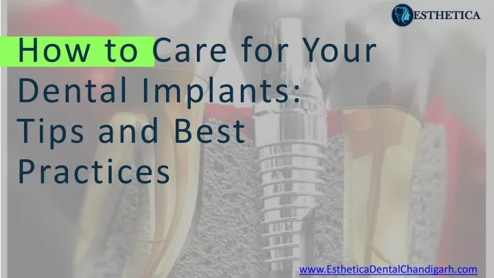 how to care for your dental implants tips