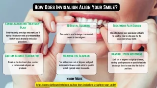 How Does Invisalign Align Your Smile?