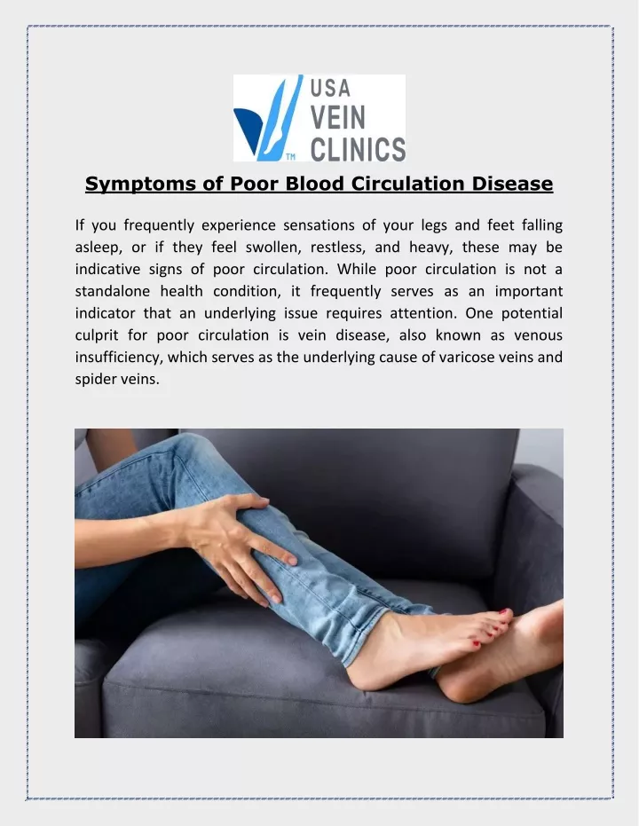symptoms of poor blood circulation disease