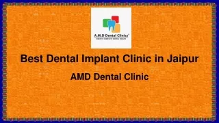 Best Dental Implant Clinic in Jaipur